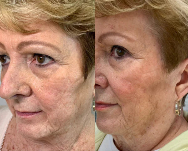 RD COSMETIC Gel Régénérant Anti-Âge Derma Collagenᴹᴰ - Lemaly salon de beaute