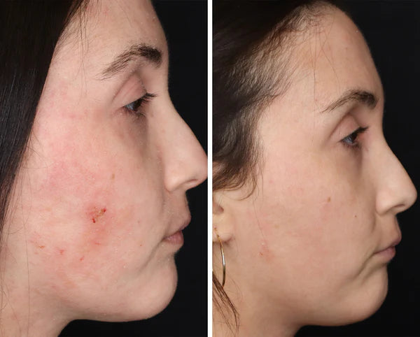 RD COSMETIC Gel Régénérant Anti-Âge Derma Collagenᴹᴰ - Lemaly salon de beaute